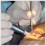 Plants: image 1 0f 4 thumb